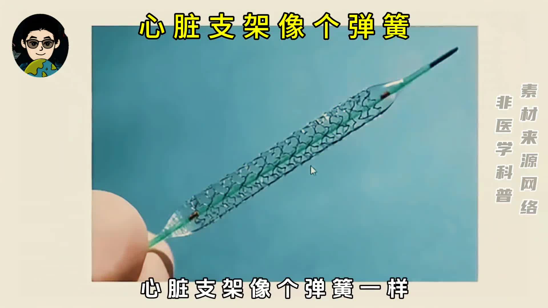 心脏支架像个弹簧大小只有2毫米却可以卖到上万元
