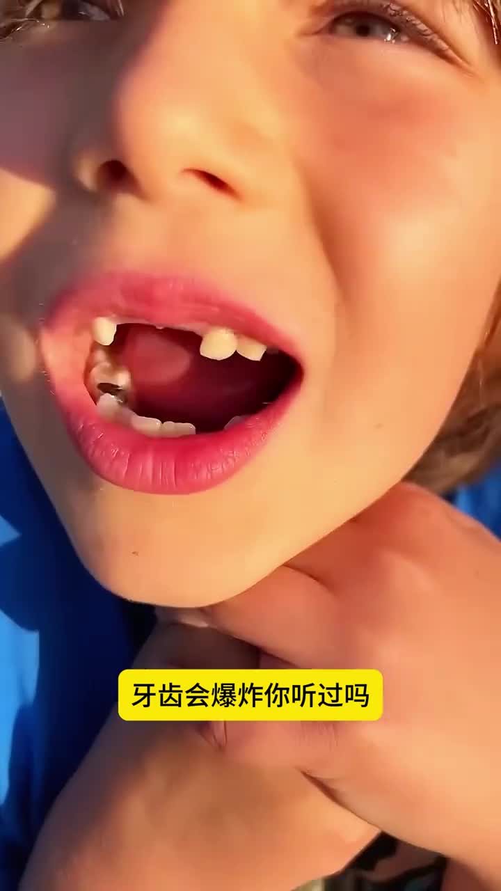 千万别经常磨牙不然会跟她一样