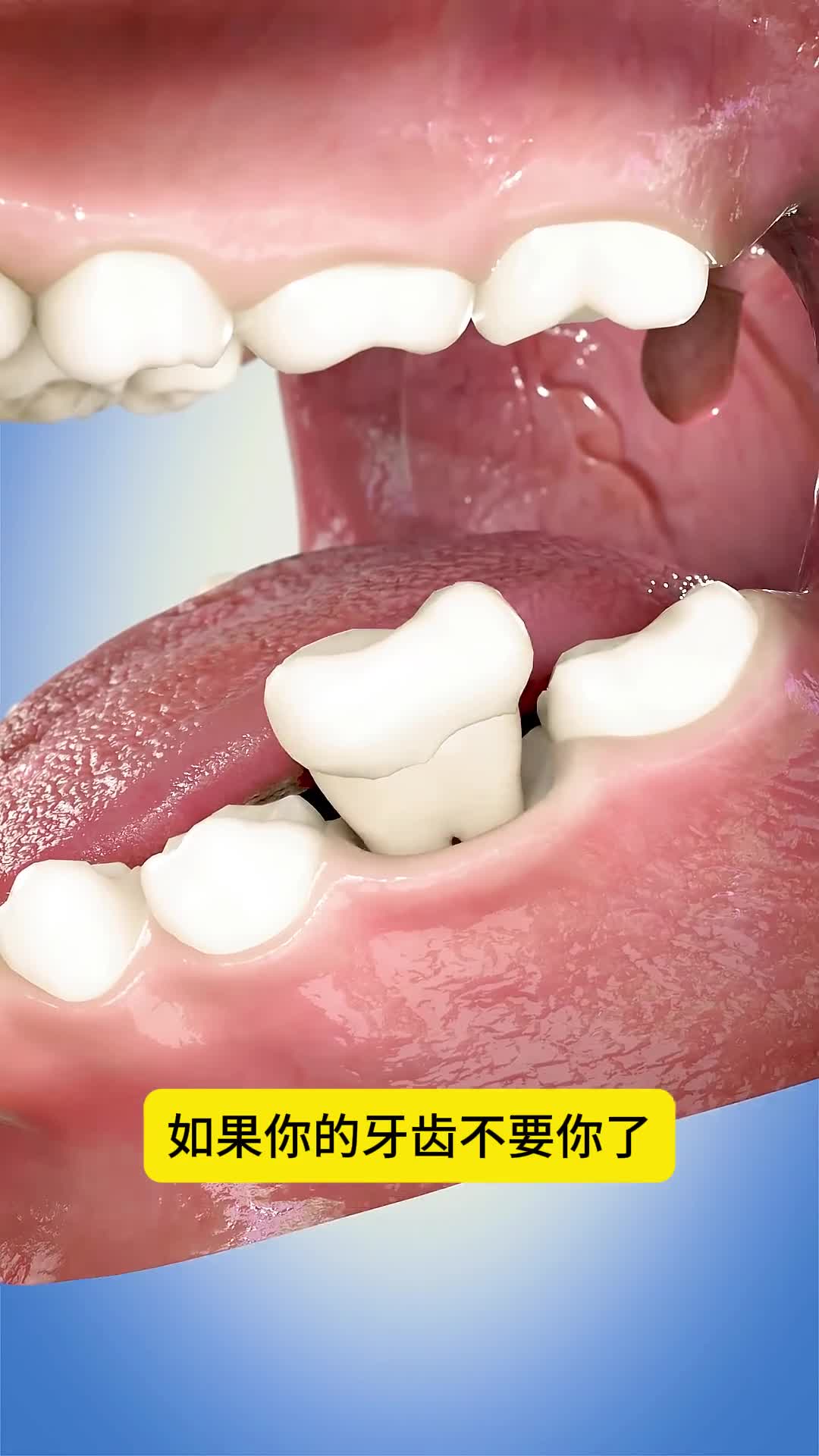 小心牙齿离开你