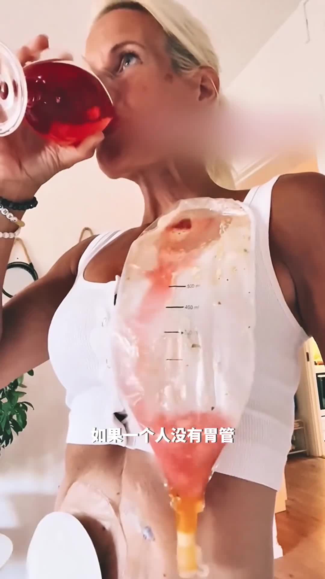 在没有胃管的情况下该如何进食从而获取营养呢