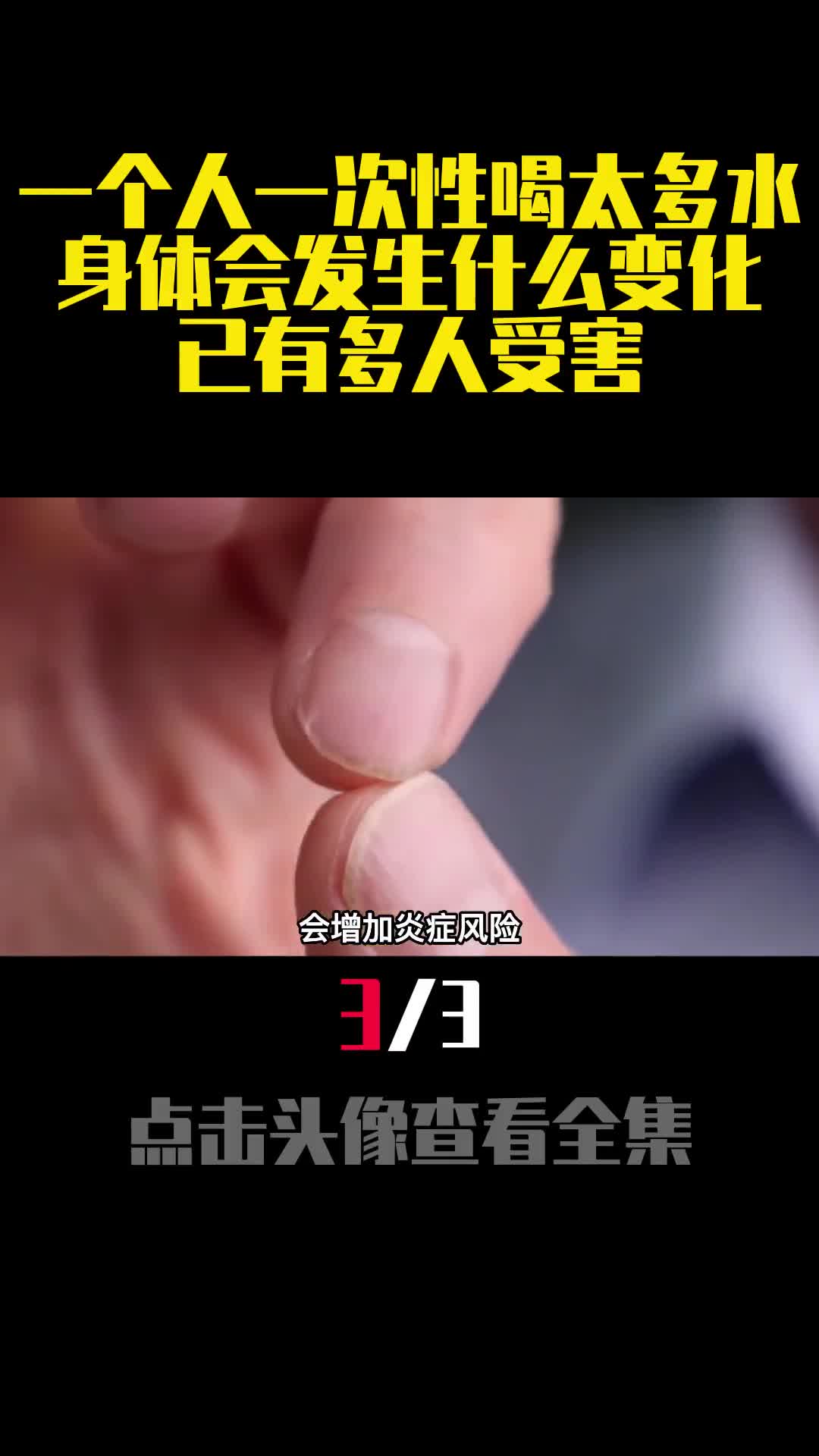 一个人一次性喝太多水身体会发生什么变化已有多人受害3