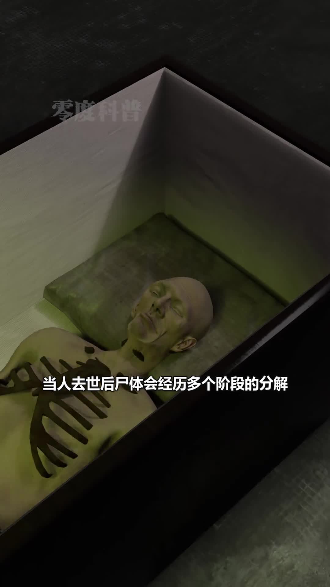 人去世后身体的变化