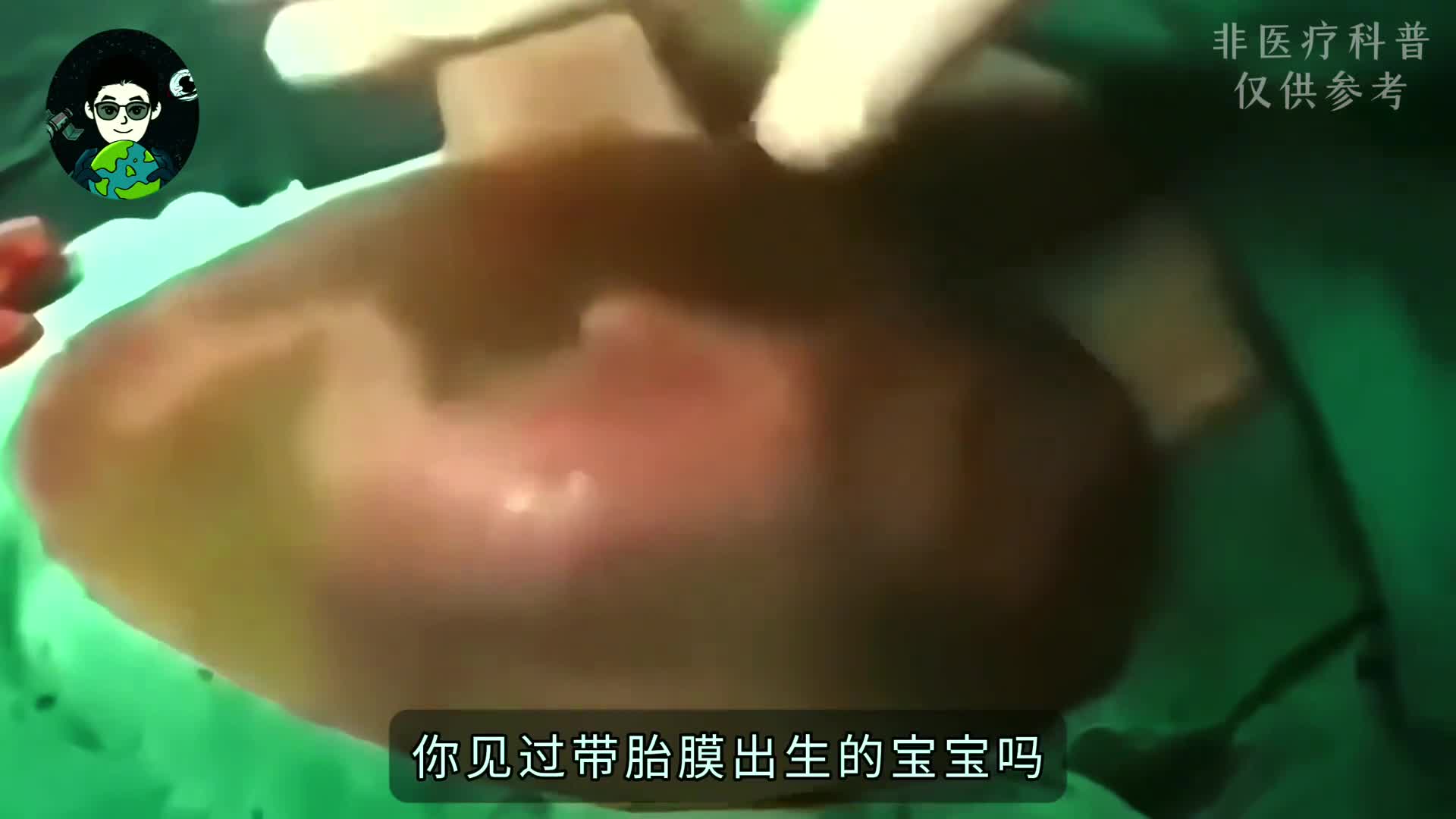 你见过带胎膜出生的宝宝吗