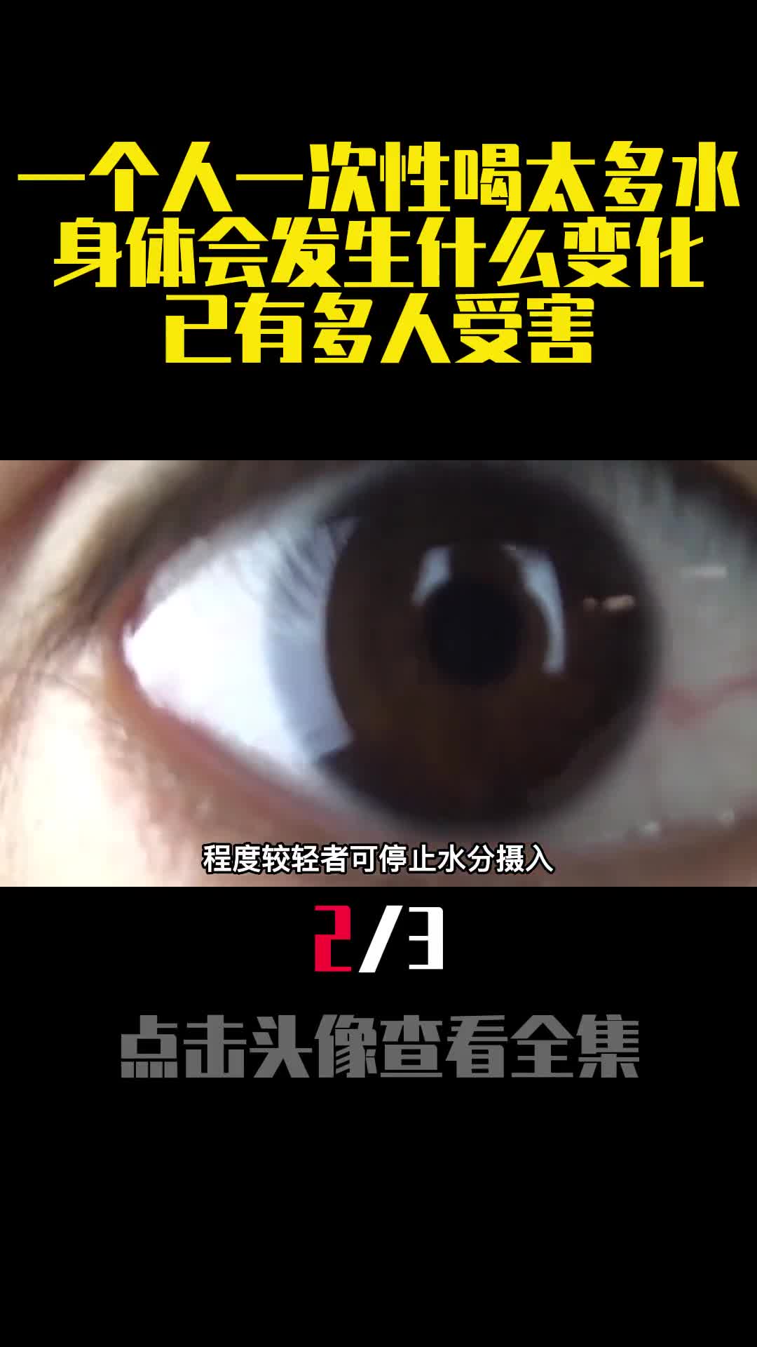 一个人一次性喝太多水身体会发生什么变化已有多人受害2