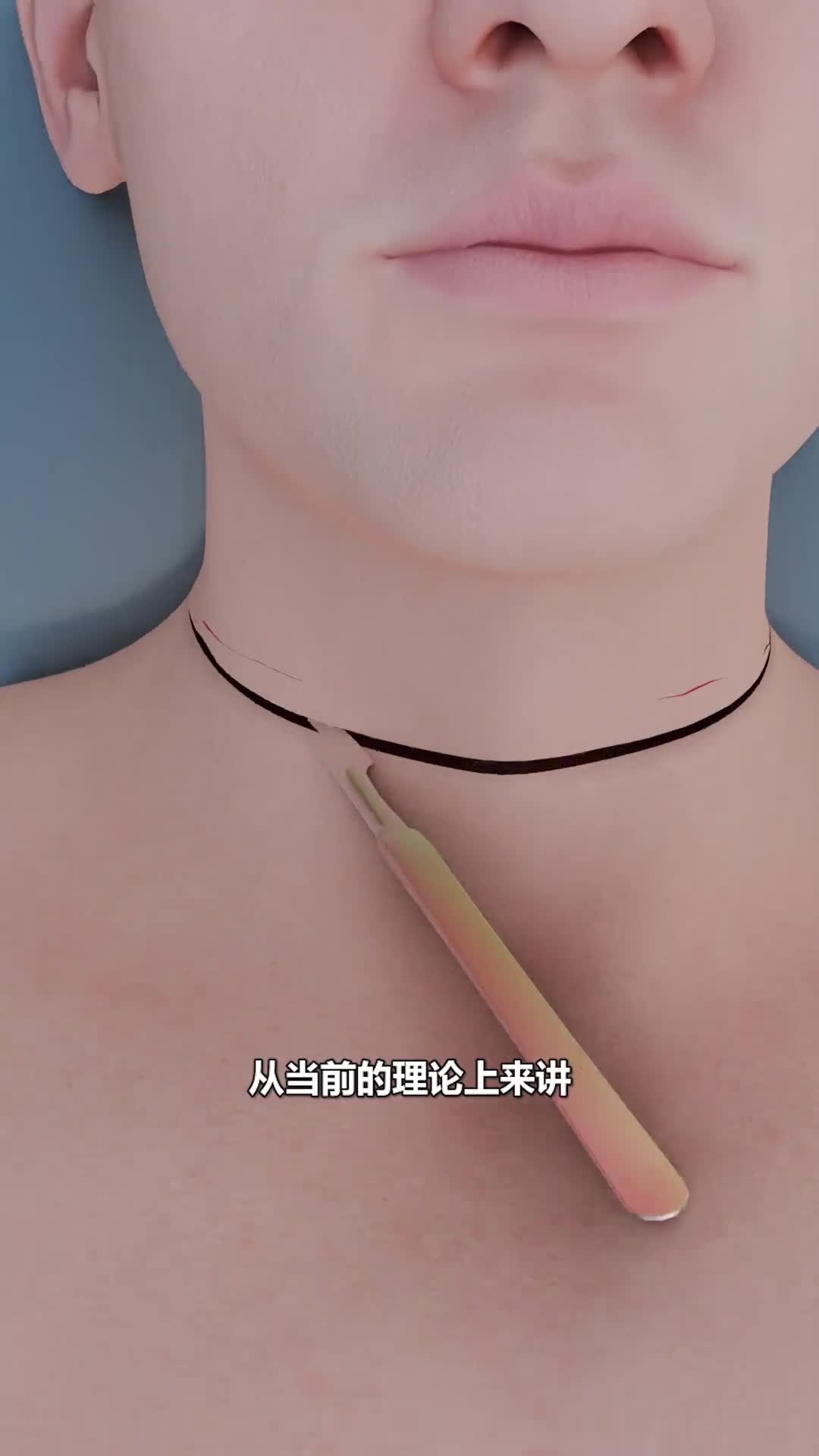 将大脑移植到另一个人的身体是真的吗