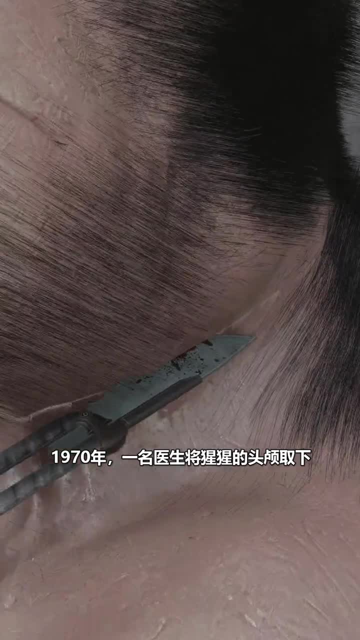 曾经一名医生为猩猩做了换头术