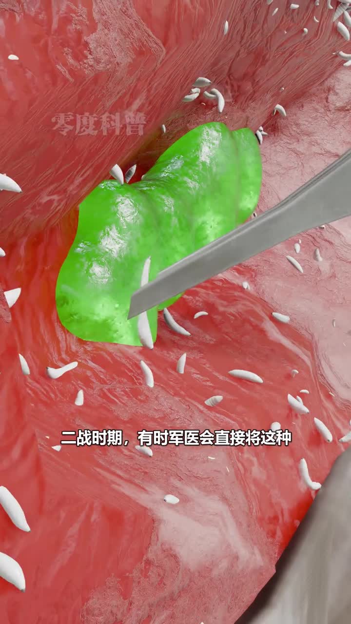 看似恶心的蛆虫却是神奇的清洁工