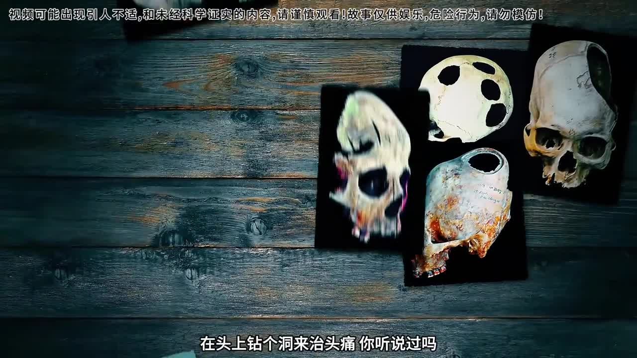 在头上开洞来治头疼古代人的方法太震惊了