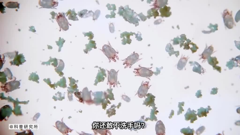 当你皮肤痒时有可能是它在咬你二