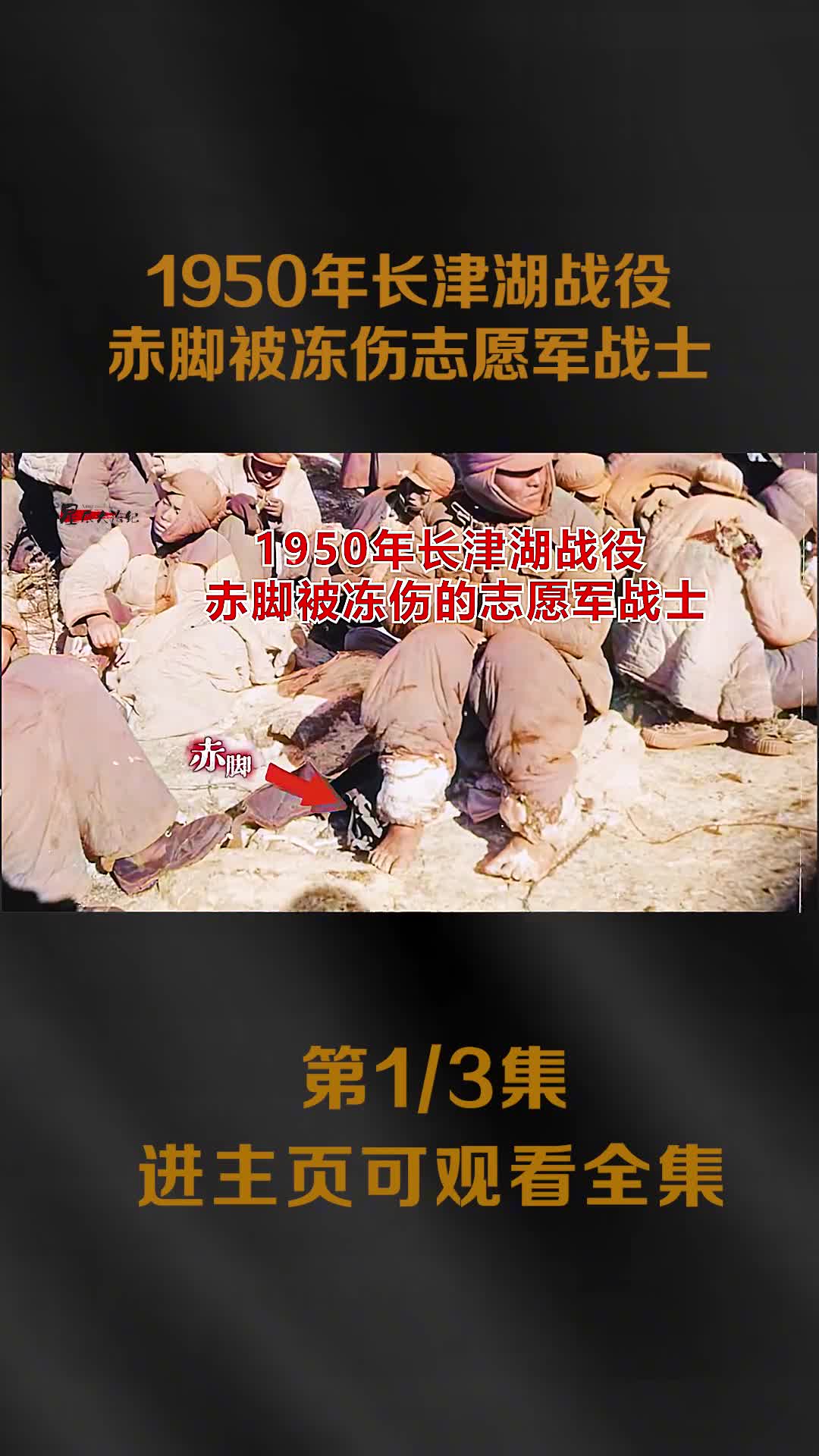 1950年抗美援朝长津湖战役赤脚被冻伤的志愿军战士让人热泪盈眶