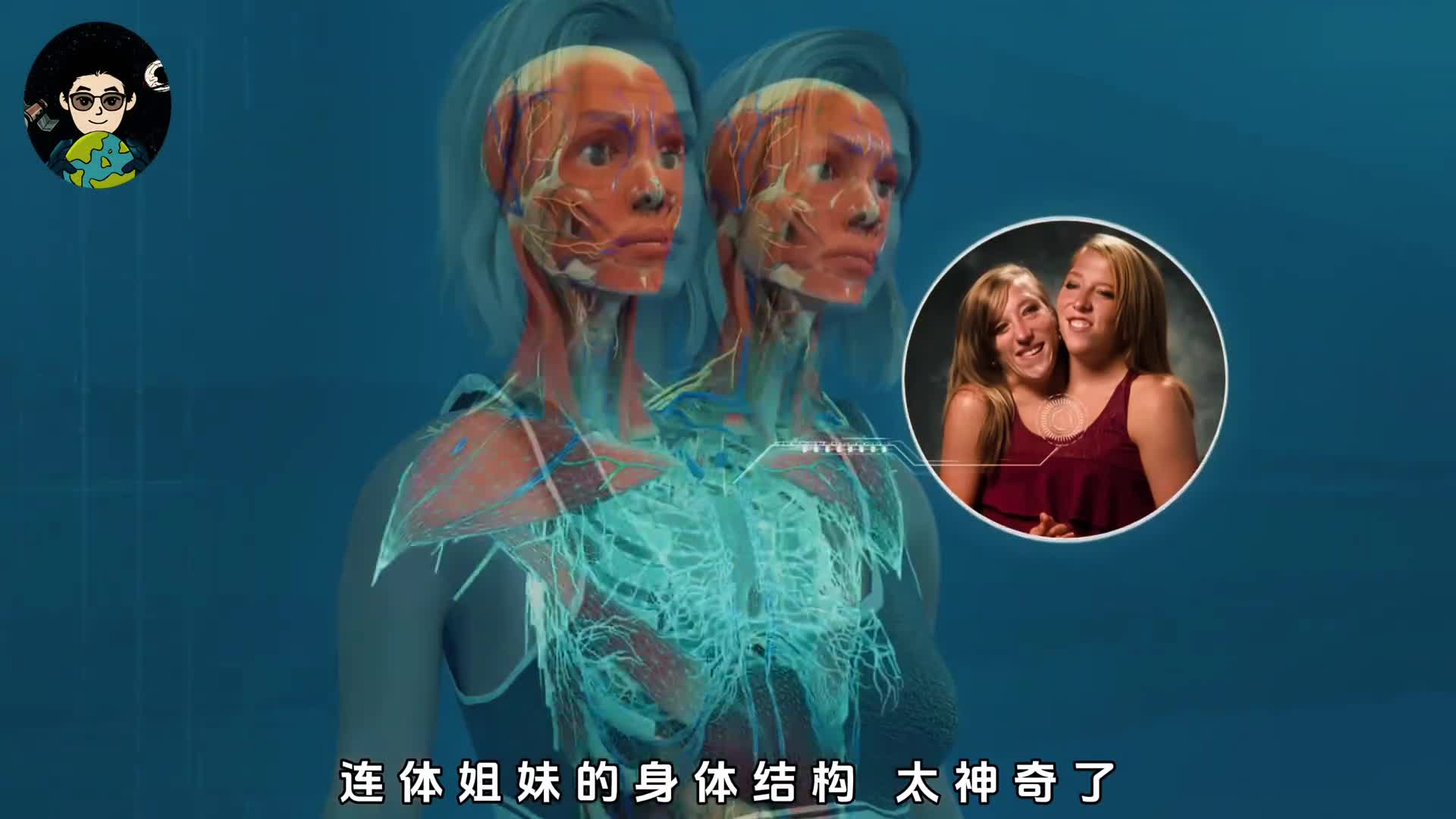 连体姐妹生的孩子应该管谁叫妈