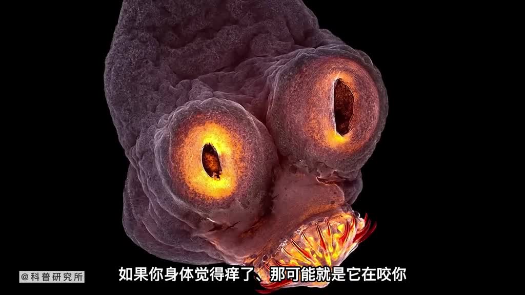 当你皮肤痒时有可能是它在咬你一