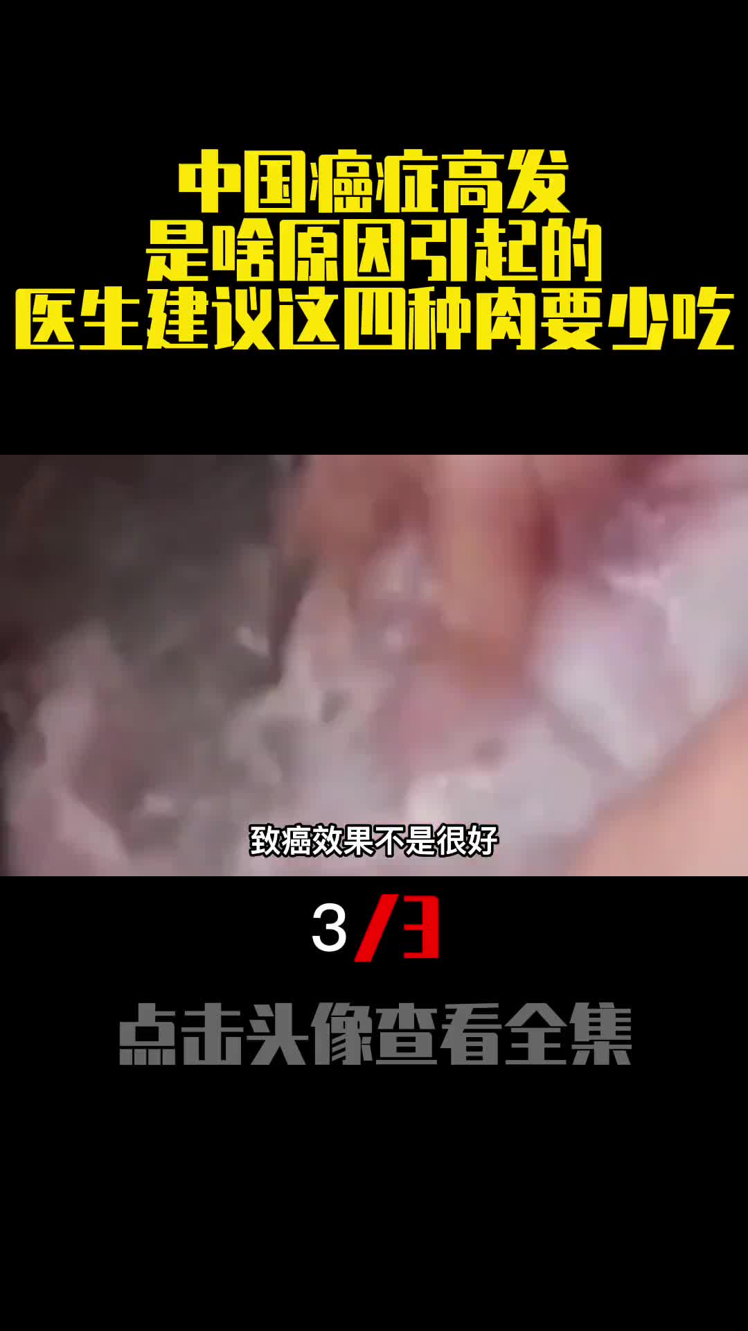 中国癌症高发是啥原因引起的医生建议这四种肉要少吃3