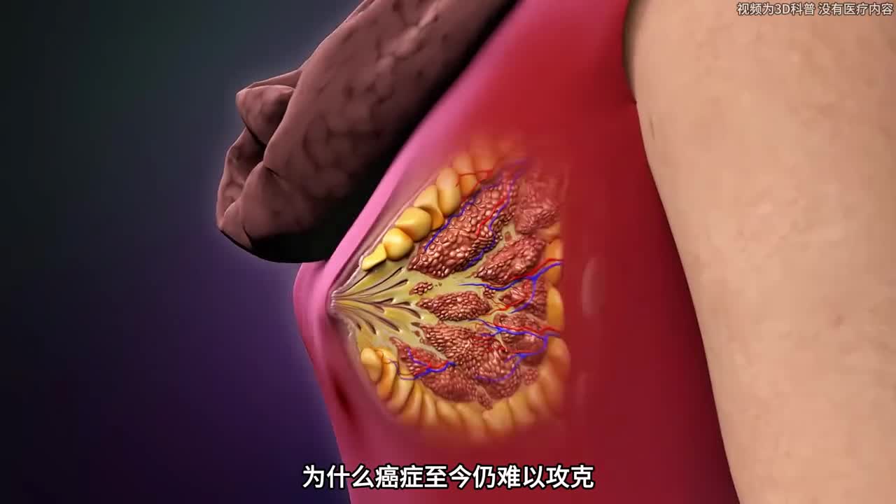 为什么癌症仍未被攻克看完你就懂了