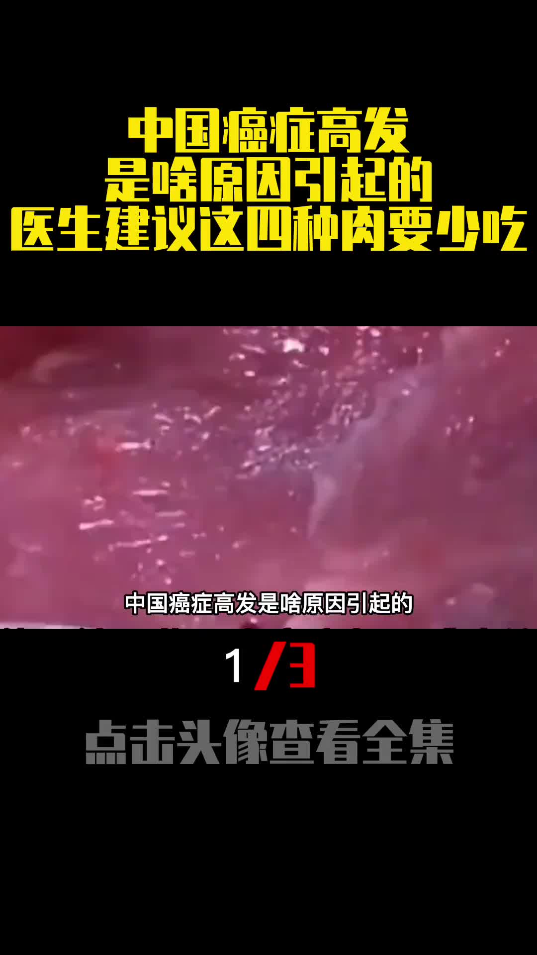 中国癌症高发是啥原因引起的医生建议这四种肉要少吃1