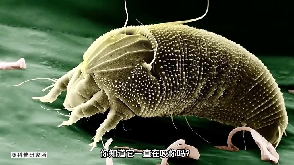 当你皮肤痒时有可能是它在咬你三