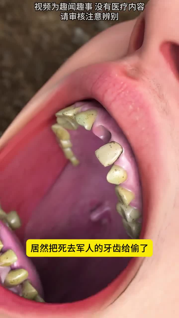 拔掉军人的牙齿为什么某些国家的奇葩行为
