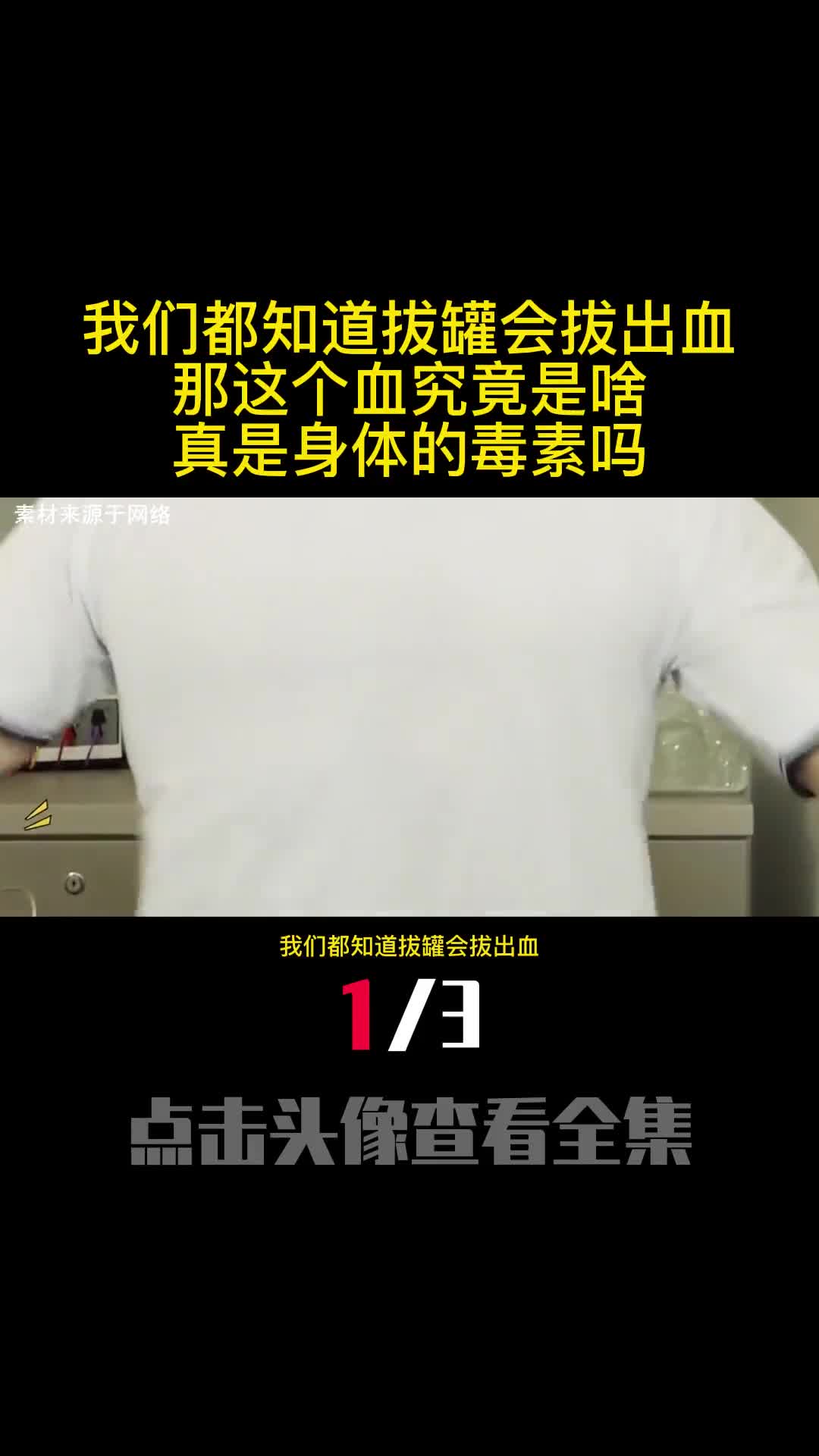 我们都知道拔罐会拔出血那这个血究竟是啥真是身体的毒素吗1