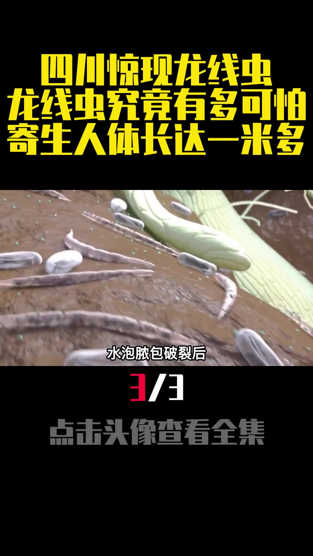四川惊现龙线虫龙线虫究竟有多可怕寄生人体长达一米多3