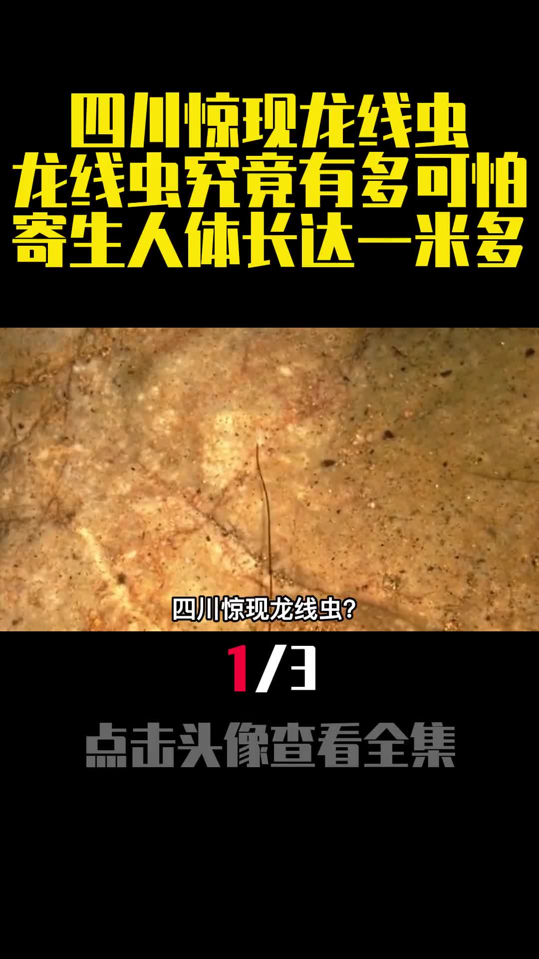 四川惊现龙线虫龙线虫究竟有多可怕寄生人体长达一米多1