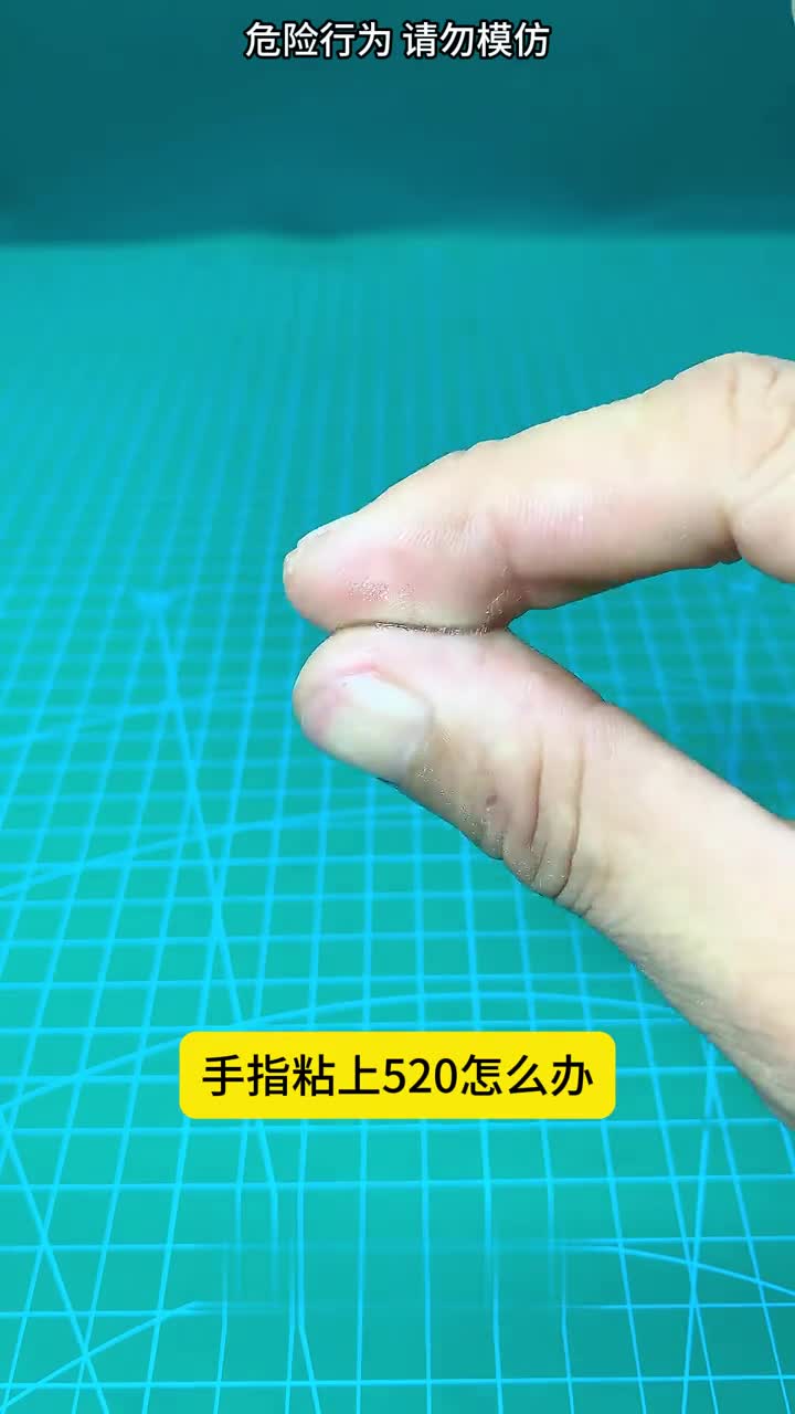 胶水粘手上怎么办5个小技巧迅速帮你解决