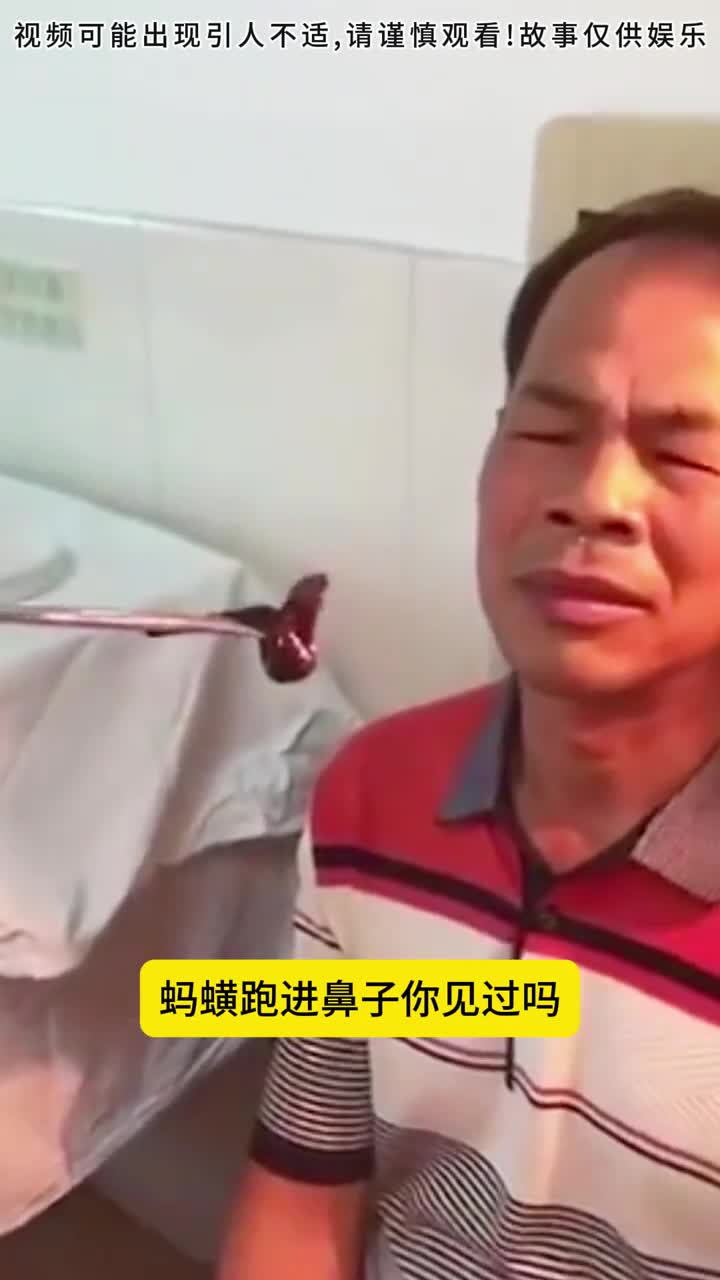 蚂蟥居然跑进了鼻子