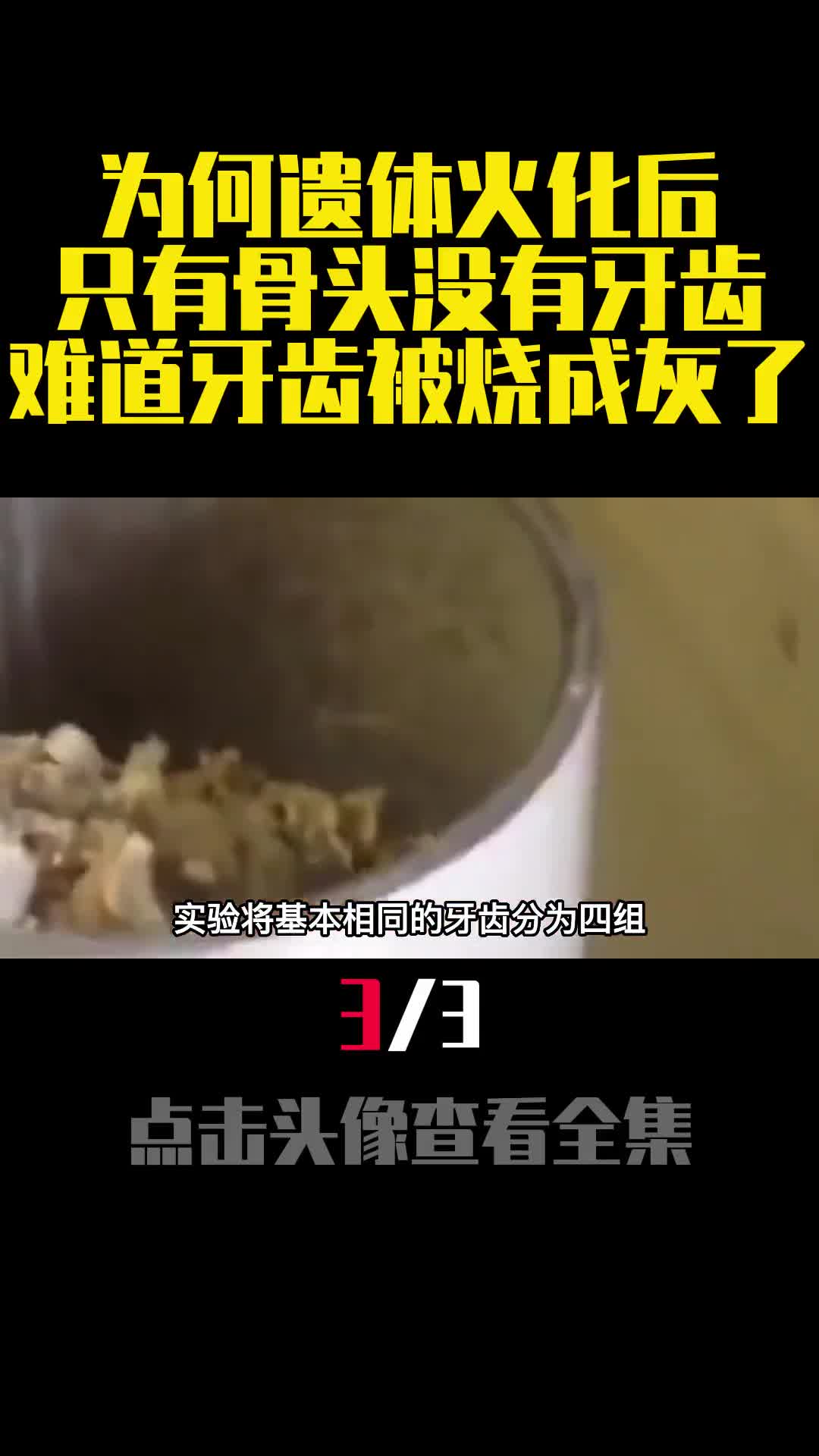 为何遗体火化后只有骨头没有牙齿难道牙齿被烧成灰了3