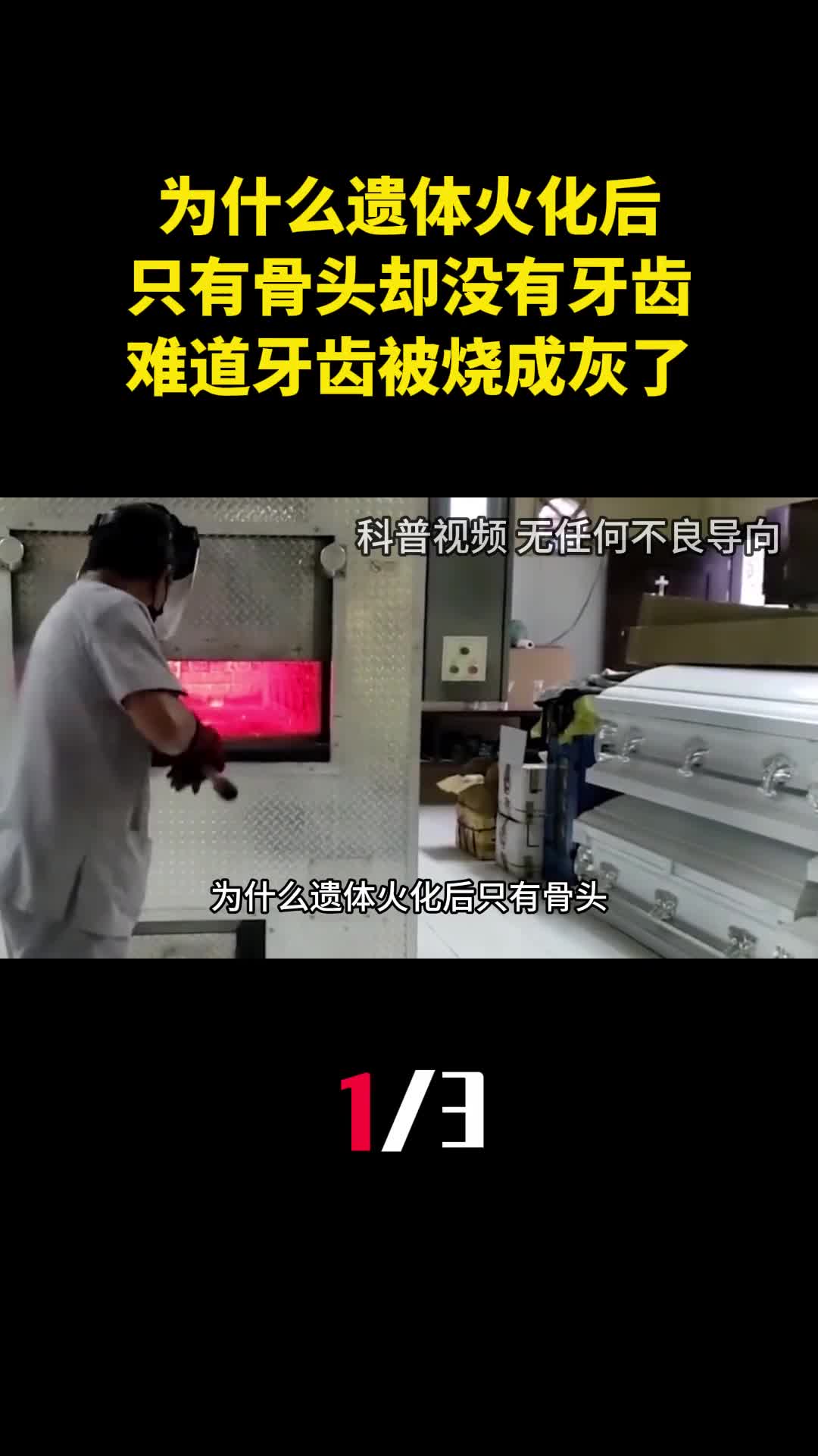 为什么遗体火化后只有骨头却没有牙齿难道牙齿被烧成灰了1