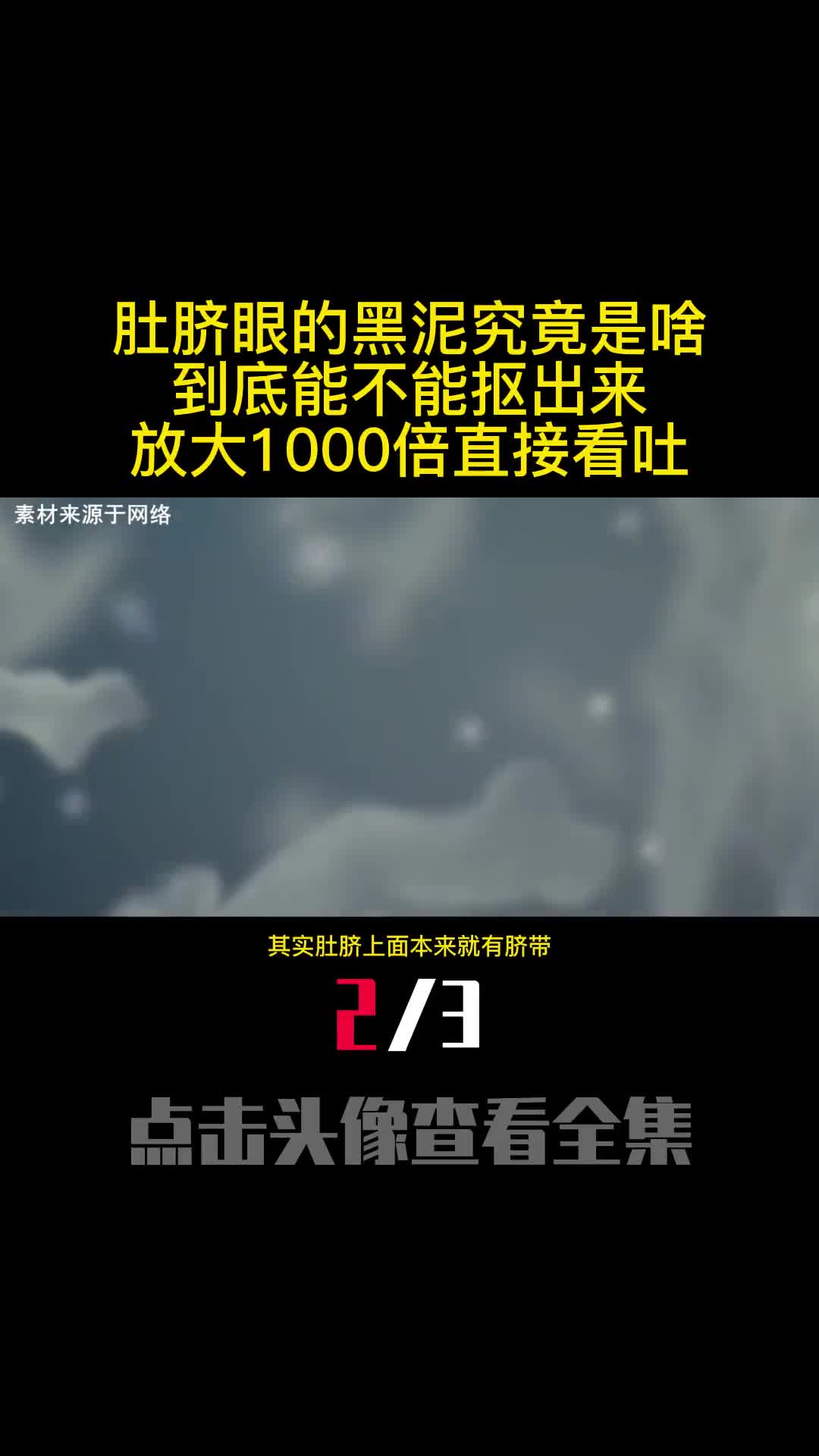 肚脐眼的黑泥究竟是啥到底能不能抠出来放大1000倍直接看吐2