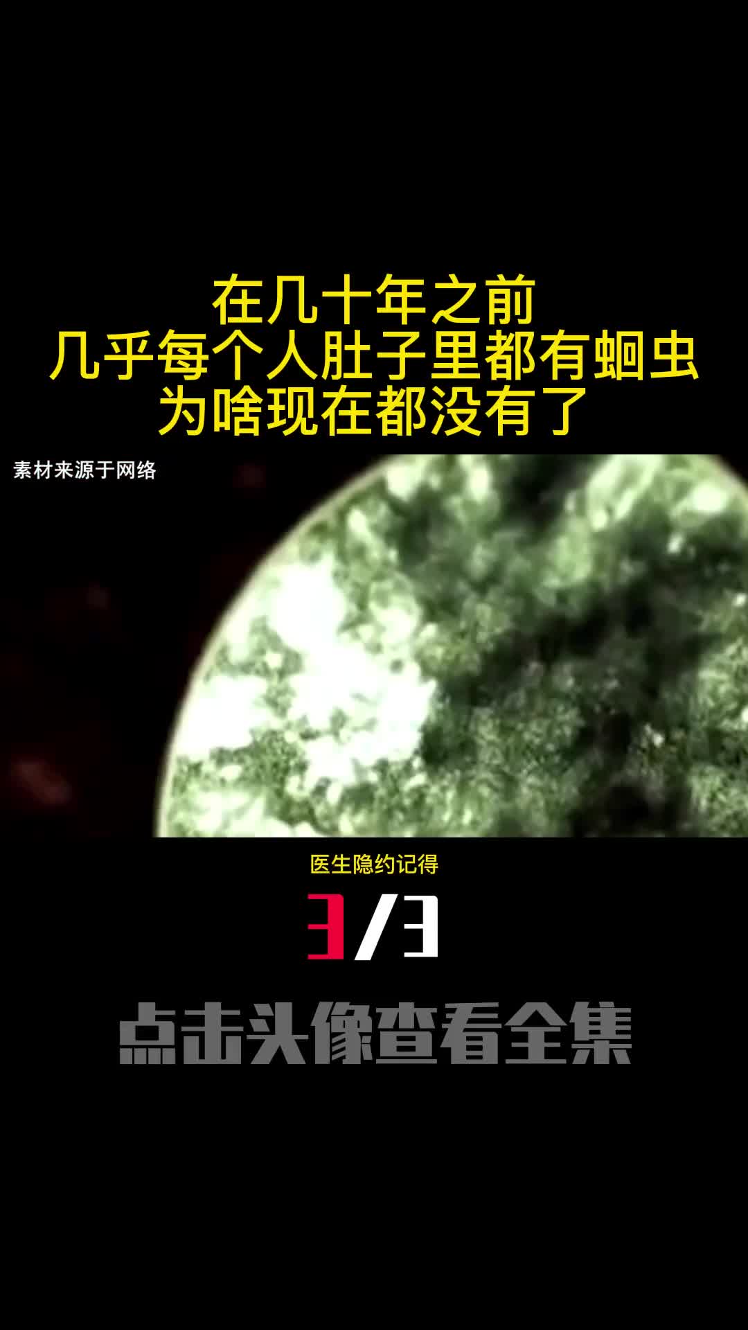 在几十年之前几乎每个人肚子里都有蛔虫为啥现在都没有了3