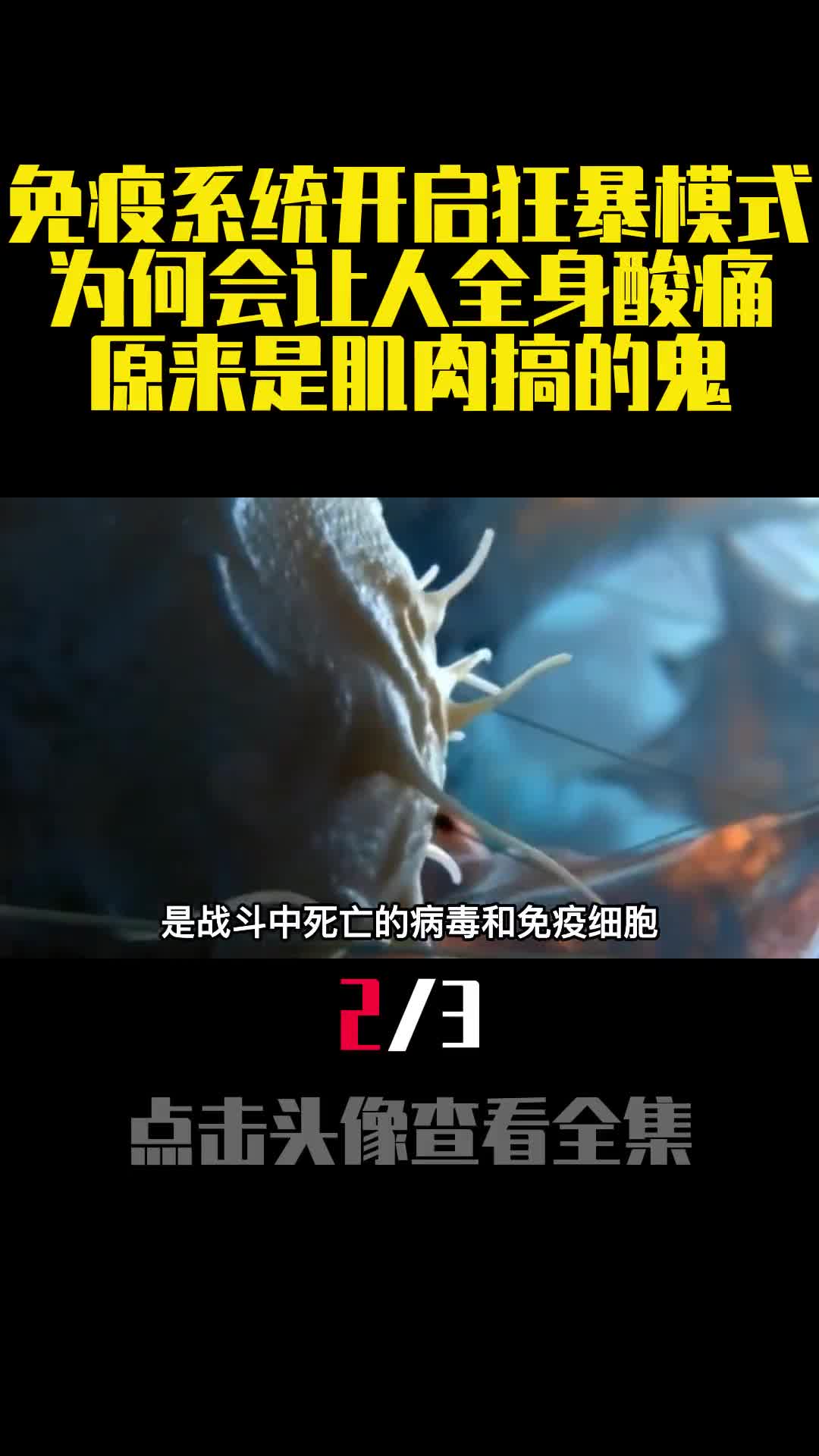 免疫系统开启狂暴模式为何会让人全身酸痛原来是肌肉搞的鬼2