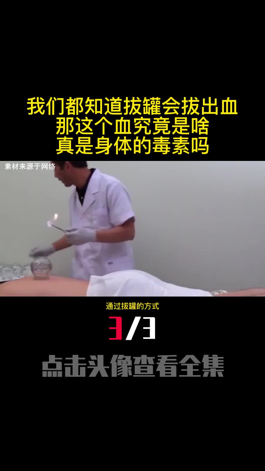 我们都知道拔罐会拔出血那这个血究竟是啥真是身体的毒素吗3