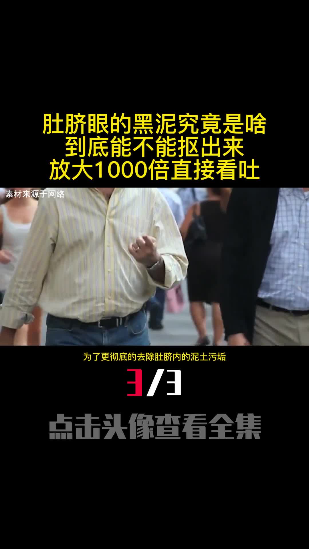 肚脐眼的黑泥究竟是啥到底能不能抠出来放大1000倍直接看吐3