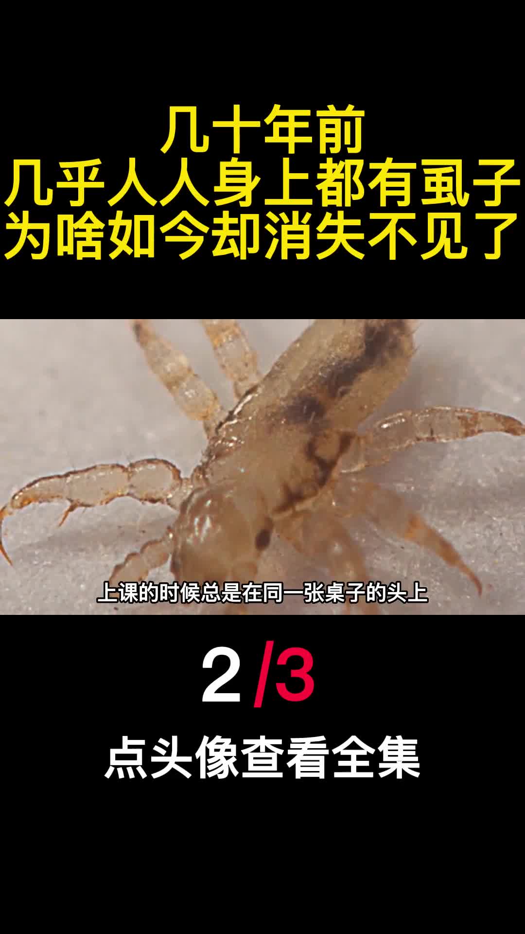 几十年前几乎人人身上都有虱子为啥如今却消失不见了2