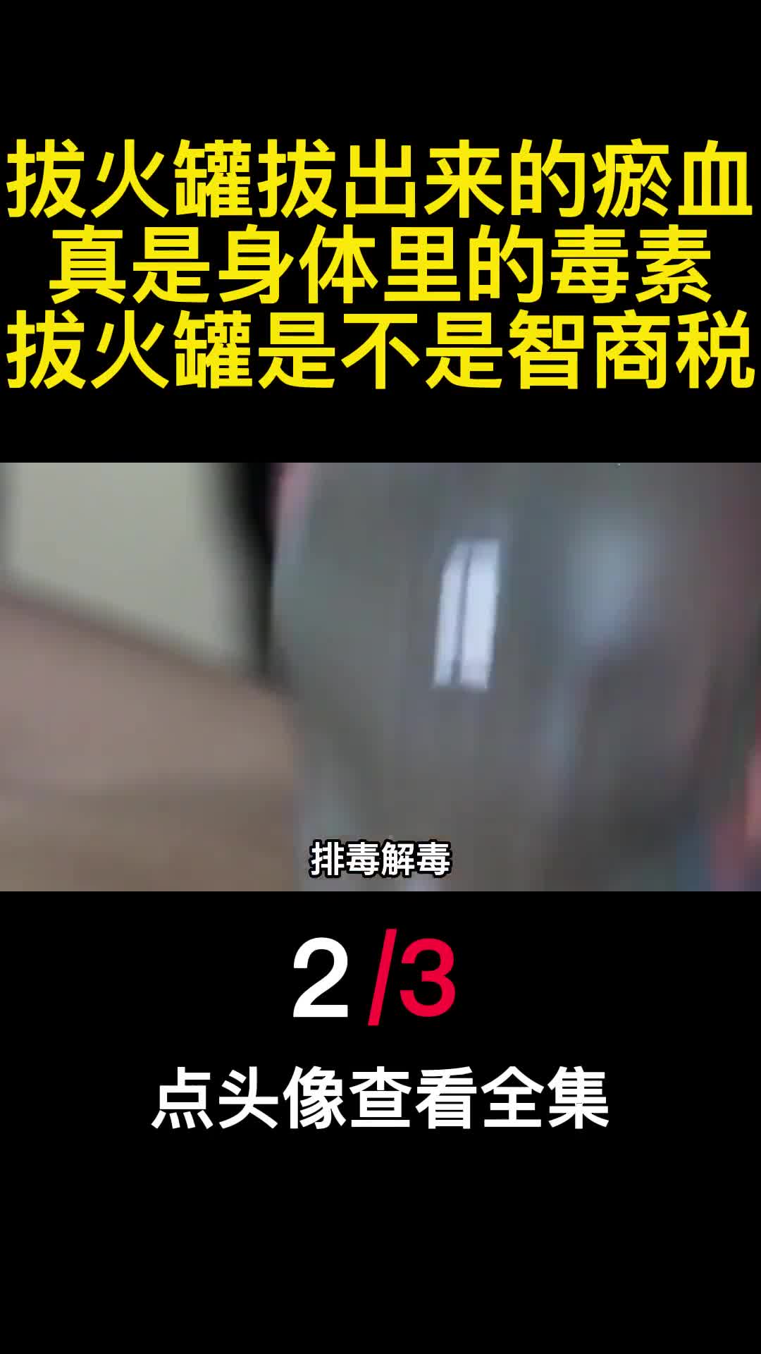 拔火罐拔出来的瘀血真是身体里的毒素拔火罐是不是智商税2