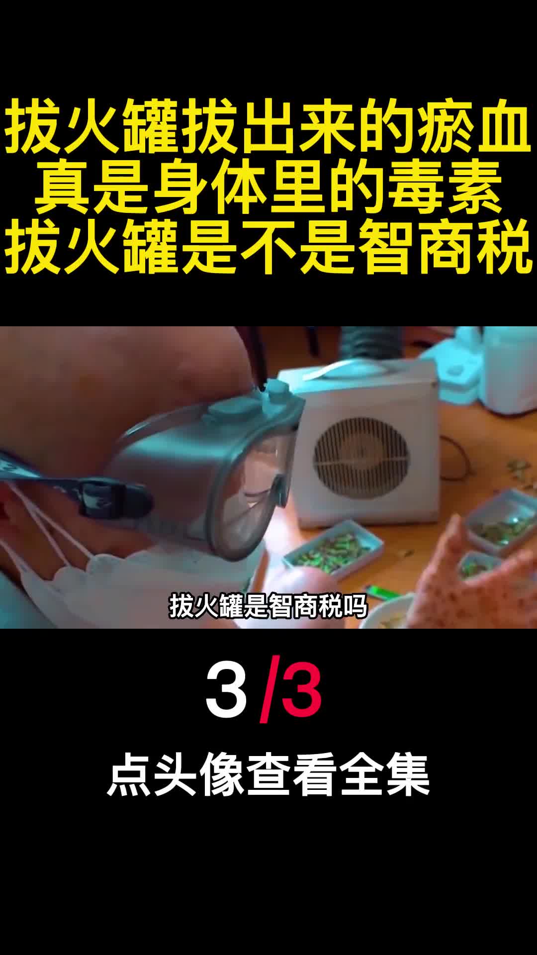 拔火罐拔出来的瘀血真是身体里的毒素拔火罐是不是智商税3