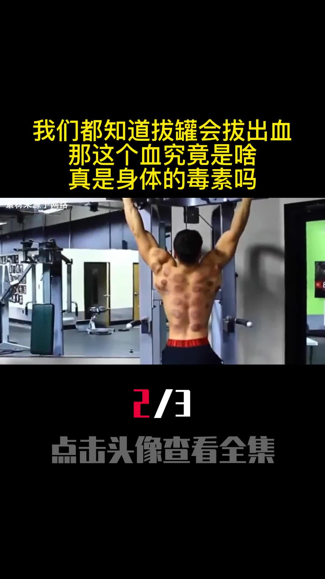 我们都知道拔罐会拔出血那这个血究竟是啥真是身体的毒素吗2