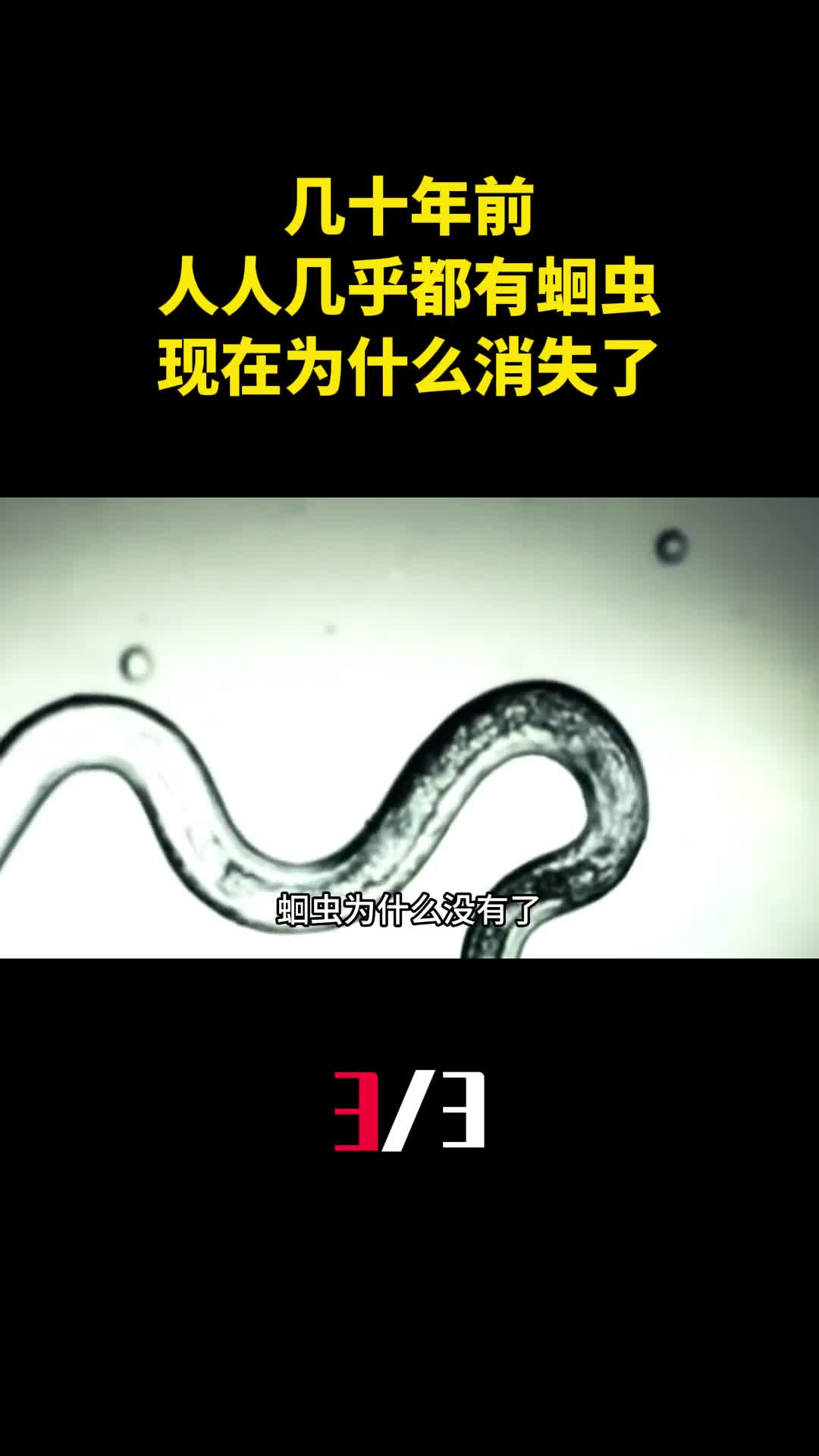 几十年前人人肚子里几乎都有蛔虫现在为什么消失了3