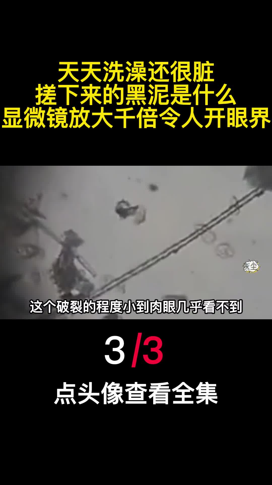 天天洗澡还很脏搓下来的黑泥是什么显微镜放大千倍令人开眼界3