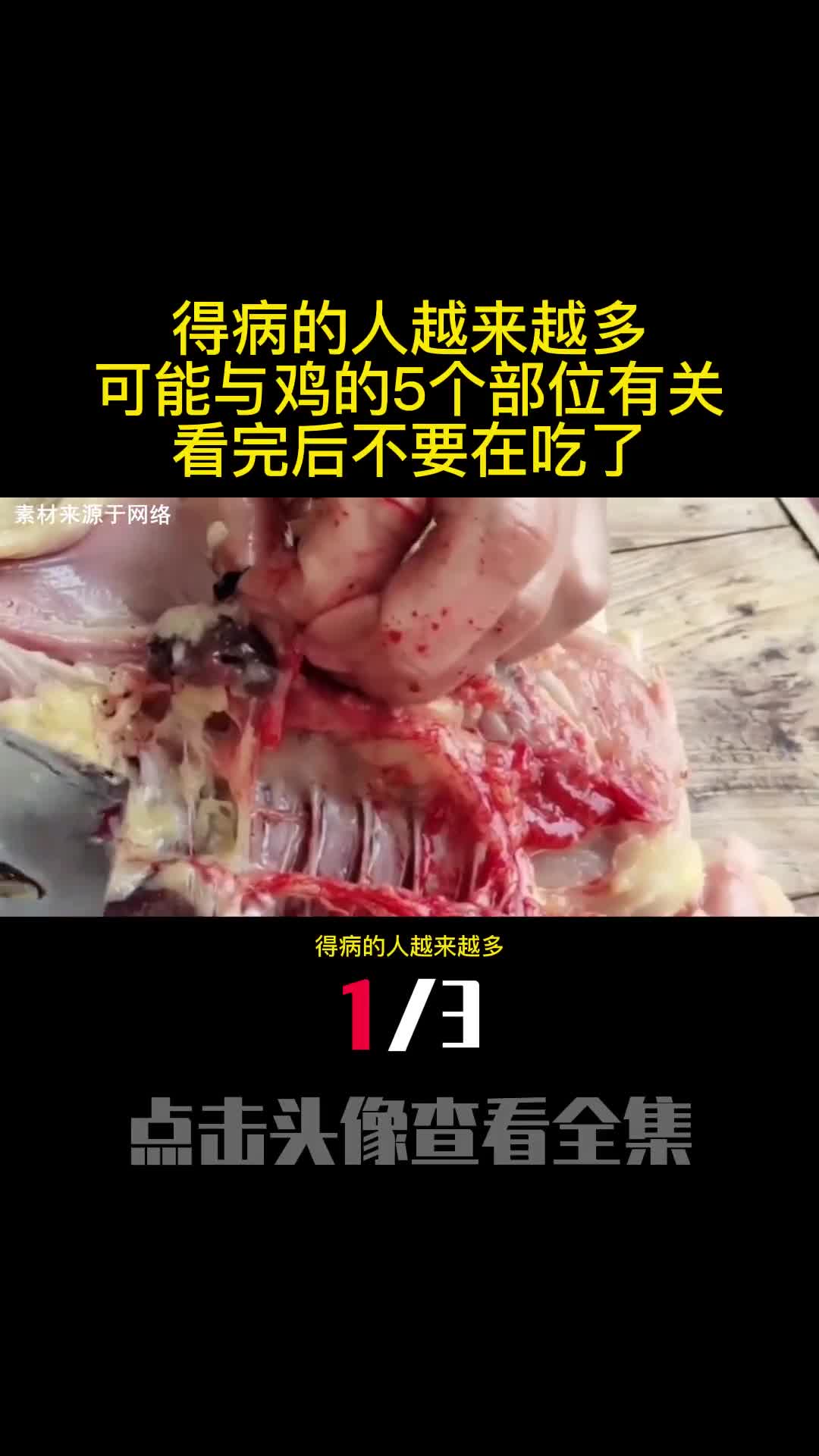 得病的人越来越多可能与鸡的5个部位有关看完后不要在吃了1
