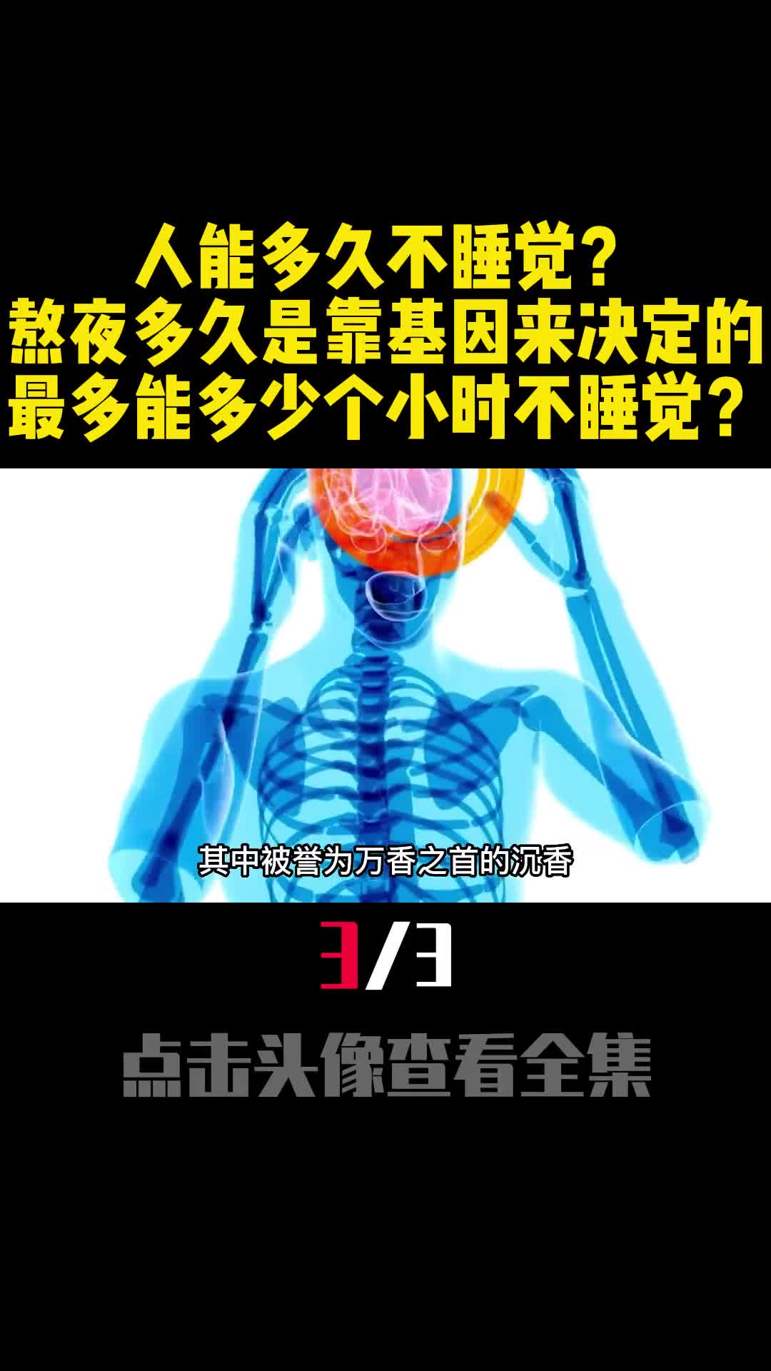 人能多久不睡觉熬夜多久是靠基因决定的最多能几个小时不睡觉3