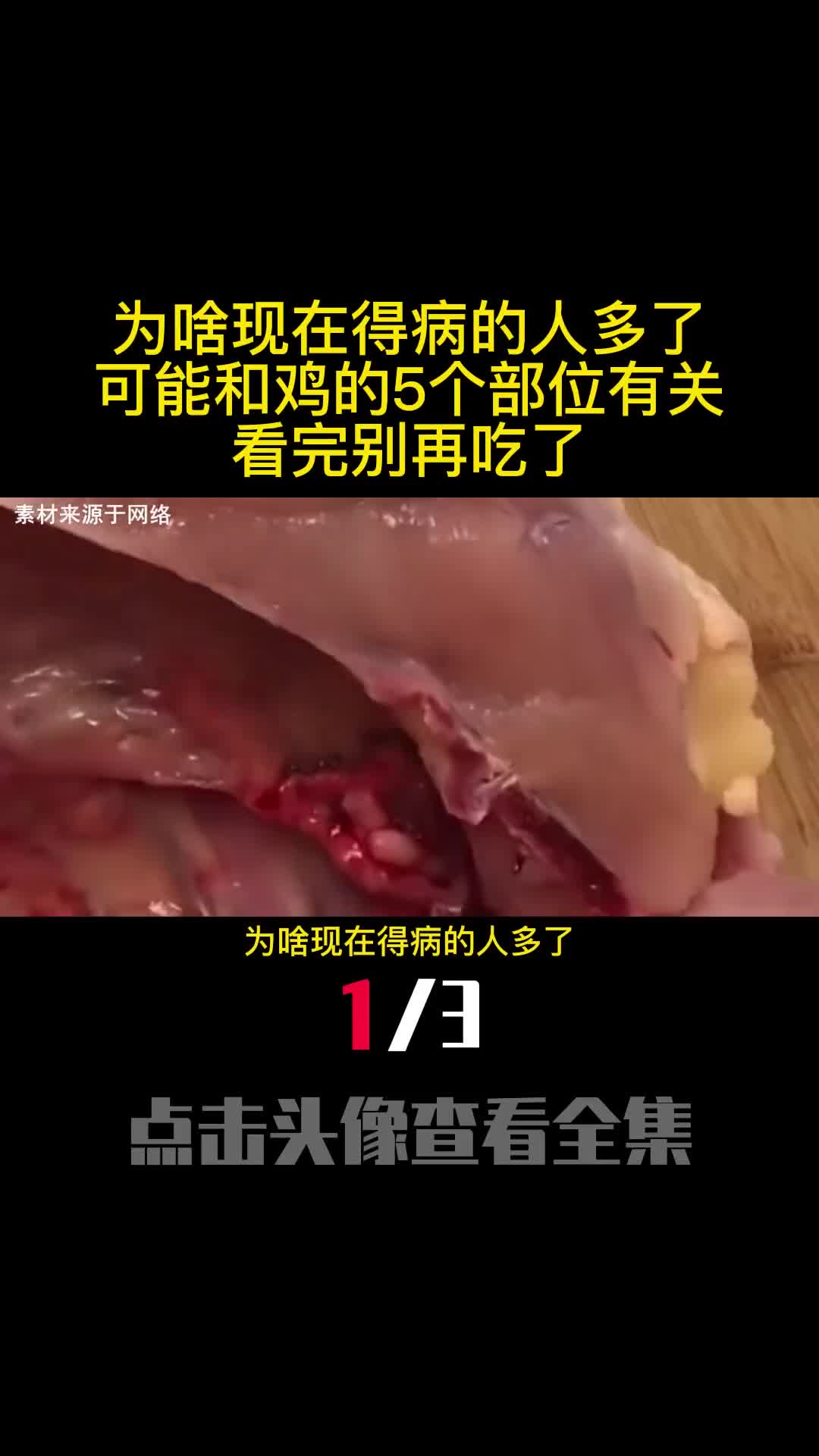 为啥现在得病的人多了可能和鸡的5个部位有关看完别再吃了1