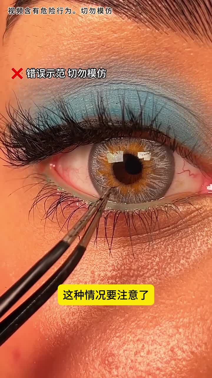 眼睛进异物了怎么办有两个简单的方法