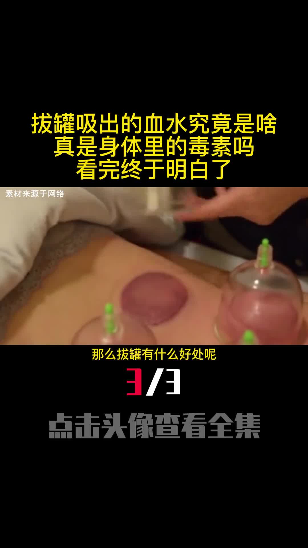 拔罐吸出的血水究竟是啥真是身体里的毒素吗看完终于明白了3