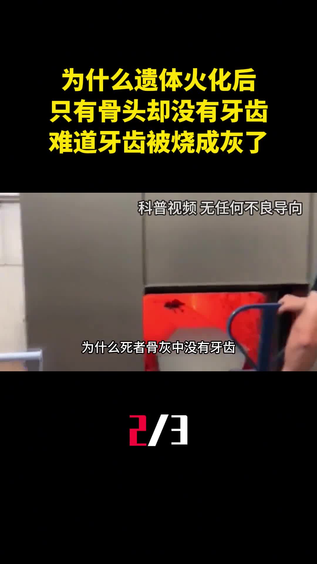 为什么遗体火化后只有骨头却没有牙齿难道牙齿被烧成灰了2
