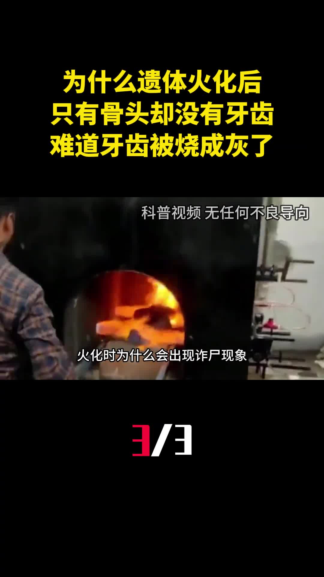 为什么遗体火化后只有骨头却没有牙齿难道牙齿被烧成灰了3