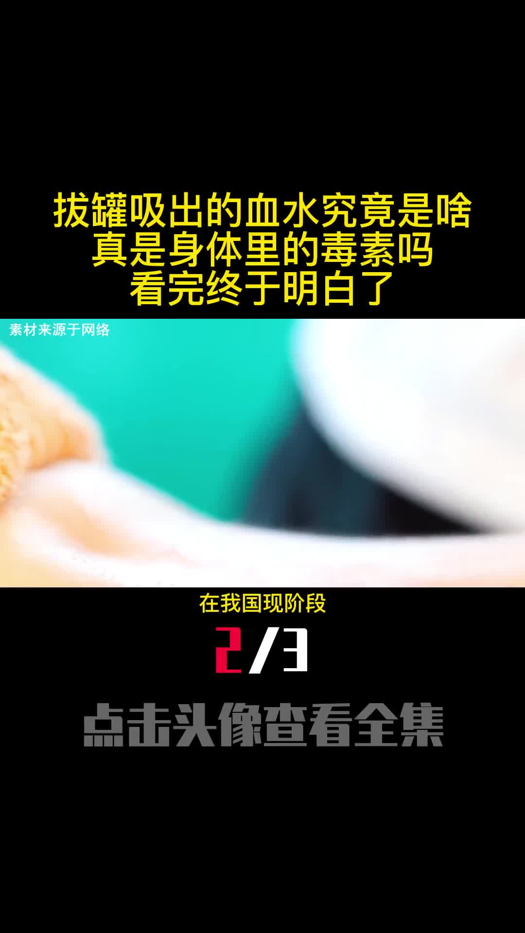 拔罐吸出的血水究竟是啥真是身体里的毒素吗看完终于明白了2