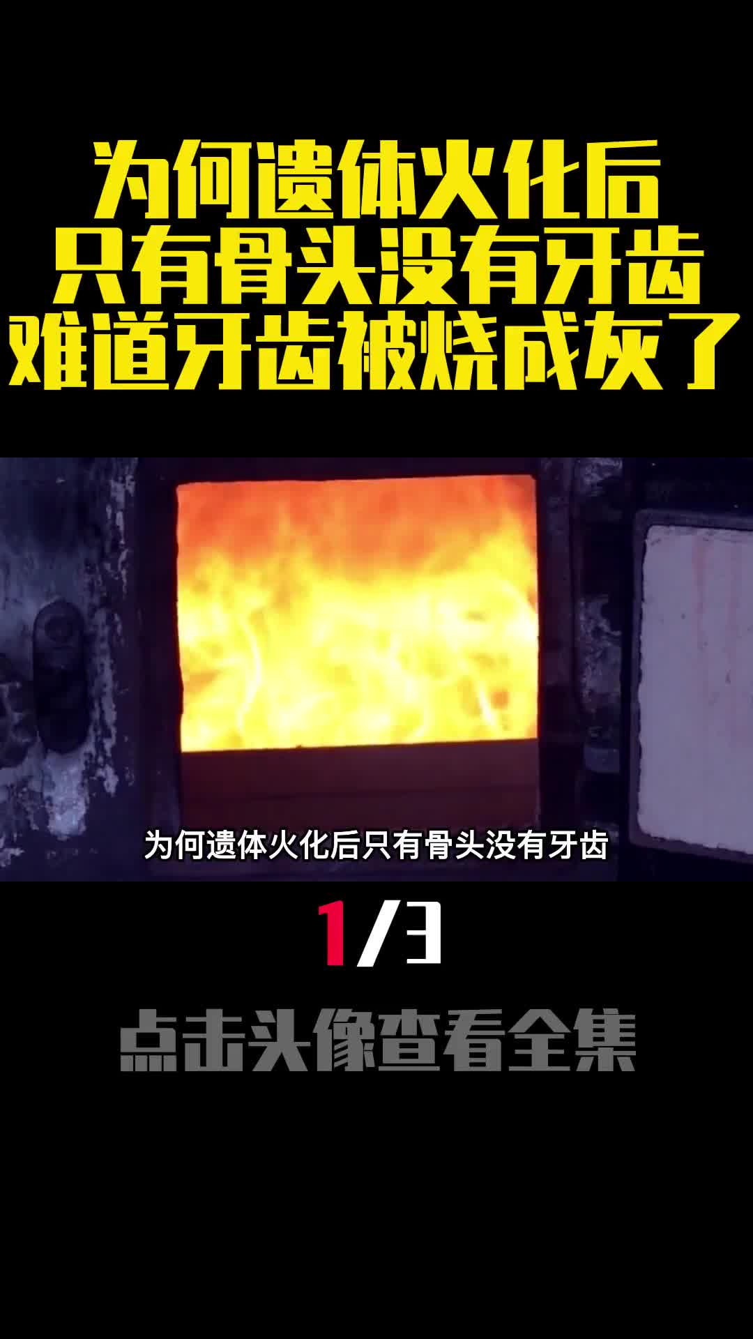 为何遗体火化后只有骨头没有牙齿难道牙齿被烧成灰了1
