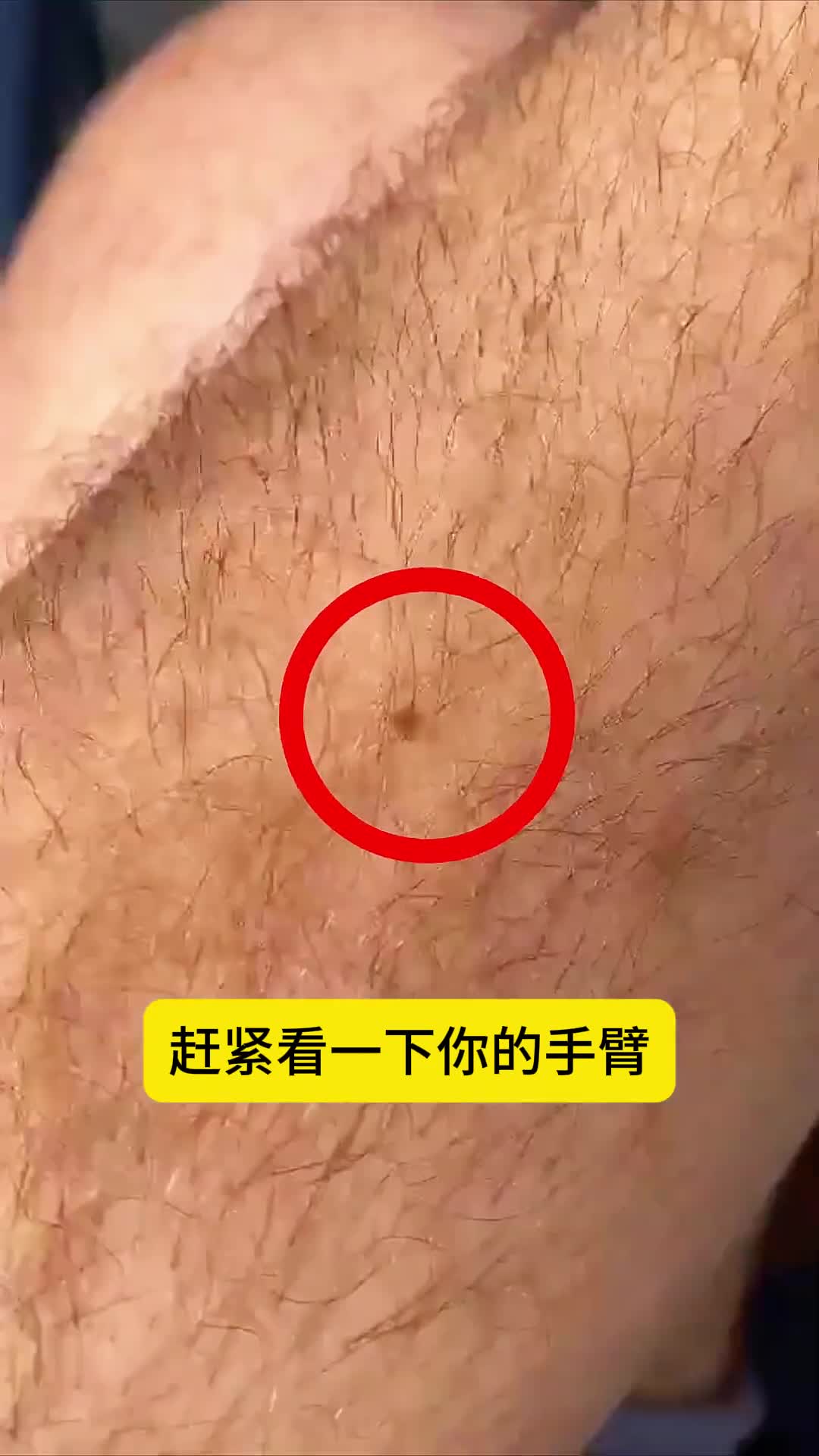 赶紧检查你的手臂有出现这个东西吗