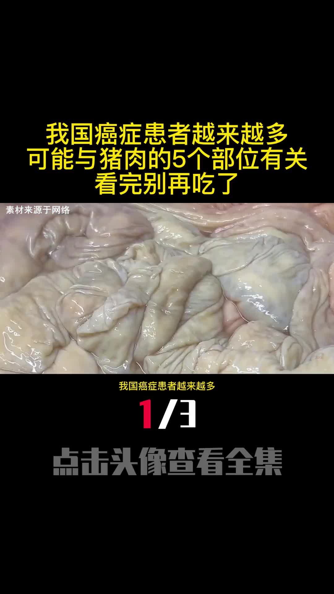 我国癌症患者越来越多可能与猪肉的5个部位有关看完别再吃了1